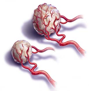 salem-vascular-surgeon-vascular-trauma