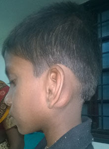 salem-vascular-surgeon-vascular-tumours