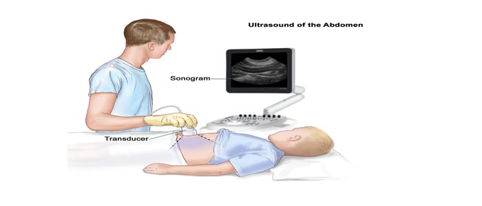 salem-vascular-surgeon-vascular-tumours